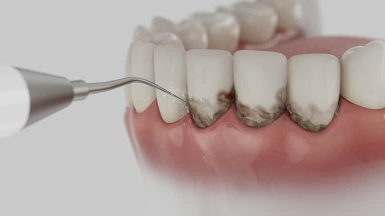 Reliable Dental Implants contractor in Northeast Ithaca, NY by Smile Center Dentistry